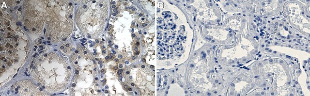 Anti-Wnt7a Antibody, clone 1D11 ZooMAb&#174; Rabbit Monoclonal recombinant, expressed in HEK 293 cells