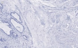 Anti-Vinculin Antibody, clone 3M13 ZooMAb&#174; Rabbit Monoclonal recombinant, expressed in HEK 293 cells