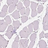 Anti-RMDN3 antibody produced in rabbit Prestige Antibodies&#174; Powered by Atlas Antibodies, affinity isolated antibody, buffered aqueous glycerol solution