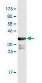 Monoclonal Anti-PDPK1, (C-terminal) antibody produced in mouse clone 2E2, purified immunoglobulin, buffered aqueous solution