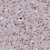 Anti-ADAMTS13 antibody produced in rabbit Prestige Antibodies&#174; Powered by Atlas Antibodies, affinity isolated antibody, buffered aqueous glycerol solution