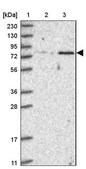 Anti-ZNF526 antibody produced in rabbit Prestige Antibodies® Powered by Atlas Antibodies, affinity isolated antibody, buffered aqueous glycerol solution