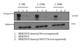 Anti-phospho Angiomotin Antibody (Ser175) from rabbit