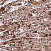 Anti-SYNPO2L antibody produced in rabbit Prestige Antibodies® Powered by Atlas Antibodies, affinity isolated antibody, buffered aqueous glycerol solution