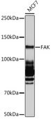 Anti-FAK Antibody, clone 7H8C4, Rabbit Monoclonal