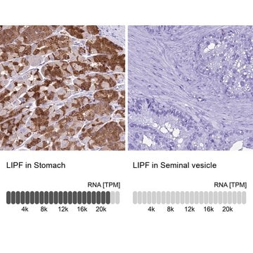 Anti-LIPF antibody produced in rabbit Prestige Antibodies&#174; Powered by Atlas Antibodies, affinity isolated antibody, buffered aqueous glycerol solution