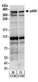 Rabbit anti-p400 Antibody, Affinity Purified Powered by Bethyl Laboratories, Inc.