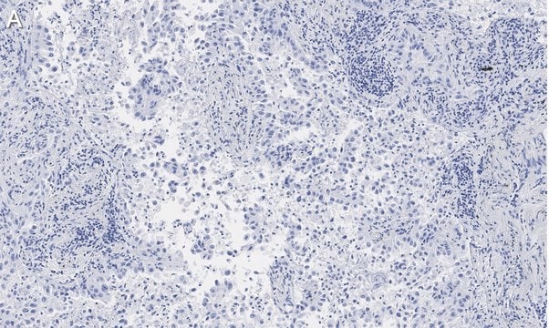 Anti-Integrin &#945;V&#946;5 Antibody, clone EM09902 , ZooMAb&#174; Rabbit Monoclonal recombinant, expressed in HEK 293 cells