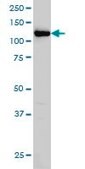 Monoclonal Anti-HIP1 antibody produced in mouse clone 1F12, purified immunoglobulin, buffered aqueous solution