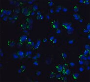 Anti-STIM1 antibody produced in rabbit affinity isolated antibody, buffered aqueous solution