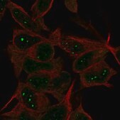 Anti-AMER3 antibody produced in rabbit Prestige Antibodies® Powered by Atlas Antibodies, affinity isolated antibody, buffered aqueous glycerol solution