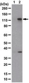 抗-磷酸-MYPT1（Thr696）抗体 from rabbit, purified by affinity chromatography