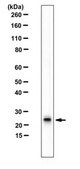 Anti-Ubiquitin Histone H2A (Lys119) Antibody from rabbit, purified by affinity chromatography