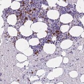 Anti-RNASE2 antibody produced in rabbit Prestige Antibodies&#174; Powered by Atlas Antibodies, affinity isolated antibody, buffered aqueous glycerol solution