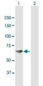 Anti-RPA1 antibody produced in mouse purified immunoglobulin, buffered aqueous solution
