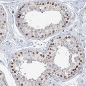 抗 KMT2D 兔抗 Prestige Antibodies® Powered by Atlas Antibodies, affinity isolated antibody, buffered aqueous glycerol solution