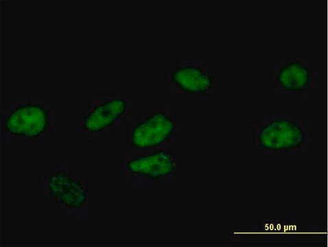 Anti-FBXO31 antibody produced in mouse IgG fraction of antiserum, buffered aqueous solution