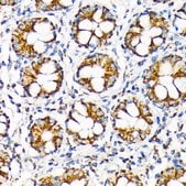 Anti-TOMM22 Antibody, clone 6R1L7, Rabbit Monoclonal