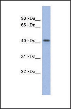 Anti-FIZ1 antibody produced in rabbit affinity isolated antibody