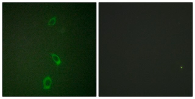 Anti-ROMK antibody produced in rabbit affinity isolated antibody