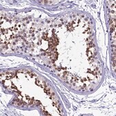Anti-SKA3 antibody produced in rabbit Prestige Antibodies&#174; Powered by Atlas Antibodies, affinity isolated antibody, buffered aqueous glycerol solution