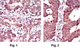Anti-ABCG5, clone 1B5E10 Antibody clone 1B5E10, from mouse