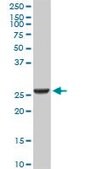 Monoclonal Anti-GSTA2, (N-terminal) antibody produced in mouse clone 3D4, purified immunoglobulin, buffered aqueous solution