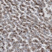 抗-ACAA1 兔抗 Ab1, Prestige Antibodies&#174; Powered by Atlas Antibodies, affinity isolated antibody, buffered aqueous glycerol solution
