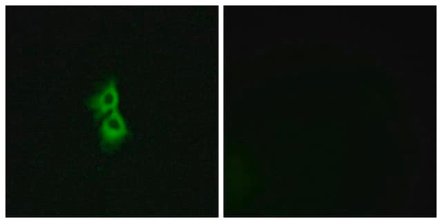 Anti-GPR22 antibody produced in rabbit affinity isolated antibody