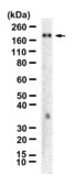 Anti-TOP2B Antibody, clone 5E7-H1 ZooMAb® Rabbit Monoclonal recombinant, expressed in HEK 293 cells