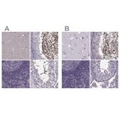 Anti-ODF3 antibody produced in rabbit Prestige Antibodies&#174; Powered by Atlas Antibodies, affinity isolated antibody, buffered aqueous glycerol solution