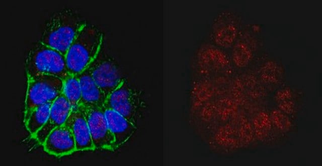 Anti-TERT Antibody from rabbit, purified by affinity chromatography