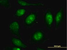 Monoclonal Anti-VIM antibody produced in mouse clone 3E9, purified immunoglobulin, buffered aqueous solution