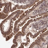 Anti-TRMU antibody produced in rabbit Prestige Antibodies&#174; Powered by Atlas Antibodies, affinity isolated antibody
