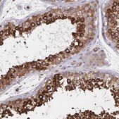 Anti-BCAP29 antibody produced in rabbit Prestige Antibodies&#174; Powered by Atlas Antibodies, affinity isolated antibody, buffered aqueous glycerol solution