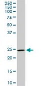 Monoclonal Anti-DCUN1D1, (N-terminal) antibody produced in mouse clone 4B5, purified immunoglobulin, buffered aqueous solution