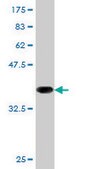 Monoclonal Anti-CD19 antibody produced in mouse clone 1C9, purified immunoglobulin, buffered aqueous solution