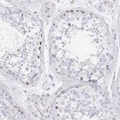 Anti-SPOCD1 antibody produced in rabbit Prestige Antibodies&#174; Powered by Atlas Antibodies, affinity isolated antibody, buffered aqueous glycerol solution