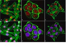 Anti-FOXA1 Antibody, clone 2F83 clone 2F83, from mouse