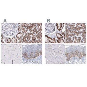 Anti-MCCC2 antibody produced in rabbit Prestige Antibodies® Powered by Atlas Antibodies, affinity isolated antibody, buffered aqueous glycerol solution