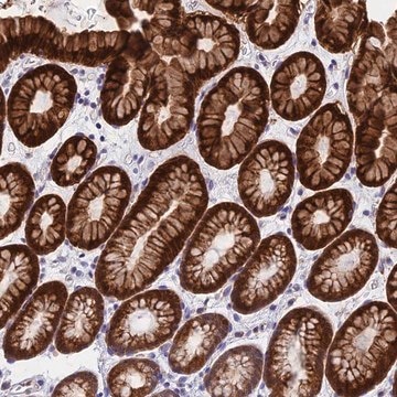 Anti-ZNF181 antibody produced in rabbit Prestige Antibodies&#174; Powered by Atlas Antibodies, affinity isolated antibody, buffered aqueous glycerol solution