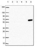 抗-KRT6A 兔抗 Prestige Antibodies&#174; Powered by Atlas Antibodies, affinity isolated antibody, buffered aqueous glycerol solution
