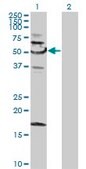 Anti-SNX4 antibody produced in mouse purified immunoglobulin, buffered aqueous solution