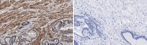 Anti-Integrin beta 1 Antibody, clone HUTS-4 ZooMAb&#174; Mouse Monoclonal recombinant, expressed in HEK 293 cells