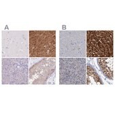 Anti-FAH antibody produced in rabbit Prestige Antibodies&#174; Powered by Atlas Antibodies, affinity isolated antibody, buffered aqueous glycerol solution