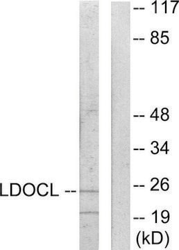 Anti-LDOC1L antibody produced in rabbit affinity isolated antibody