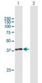 Anti-SUGT1 antibody produced in mouse purified immunoglobulin, buffered aqueous solution