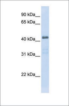 Anti-SLC29A2 antibody produced in rabbit affinity isolated antibody