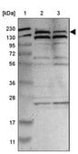 Anti-PARP14 antibody produced in rabbit Prestige Antibodies&#174; Powered by Atlas Antibodies, affinity isolated antibody, buffered aqueous glycerol solution