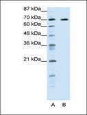 Anti-FOXK2 (AB1) antibody produced in rabbit affinity isolated antibody, lyophilized powder